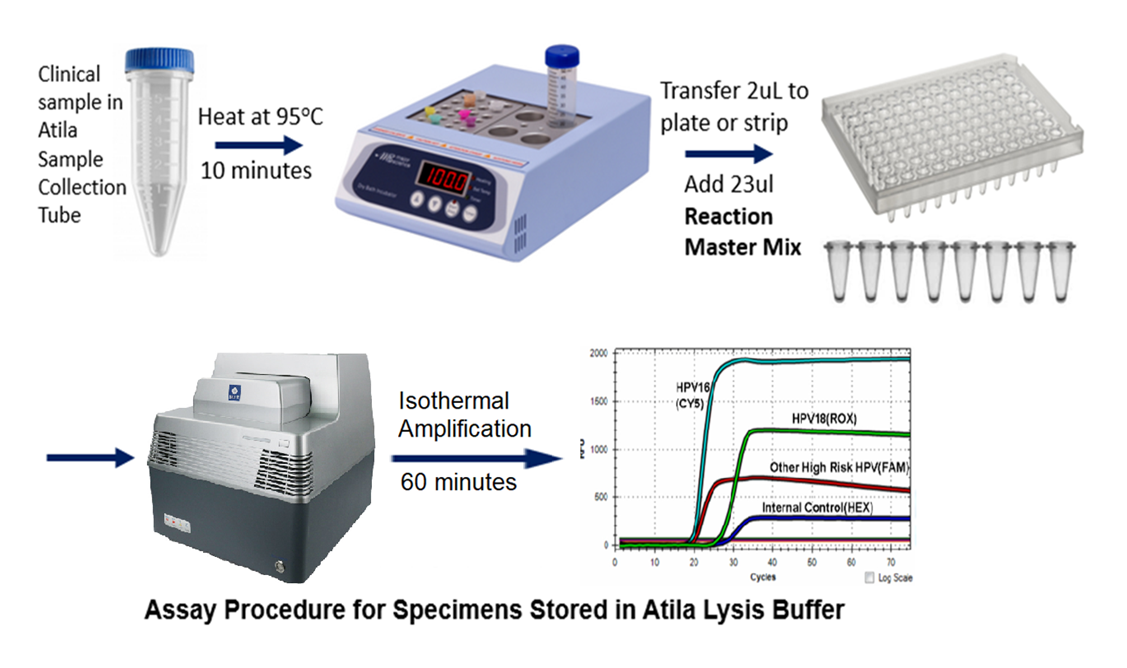 Multiplex HIGH RISK HPV by FLUORESCENT DETECTION | Molecular Biology ...